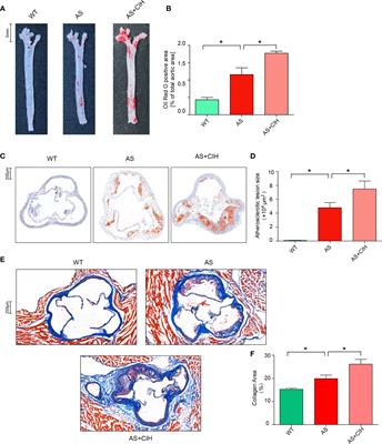 Frontiers Chronic Intermittent Hypoxia Participates In The